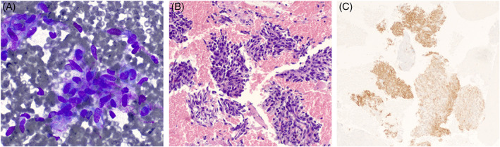 FIGURE 3