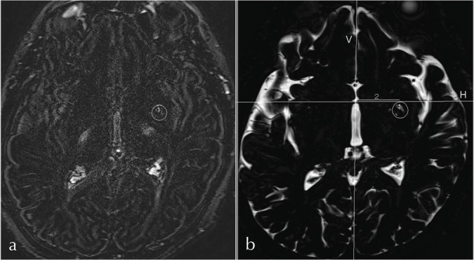 Fig 2.