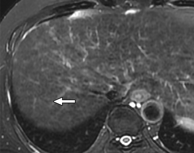 Figure 7c: