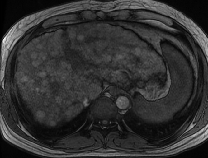 Figure 5b: