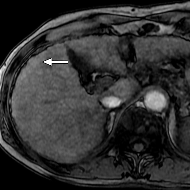 Figure 6b: