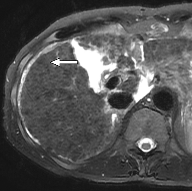 Figure 6c: