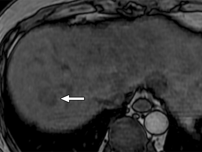 Figure 7b: