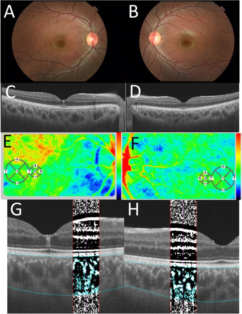 Fig. 2