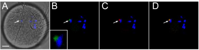 Fig. 2