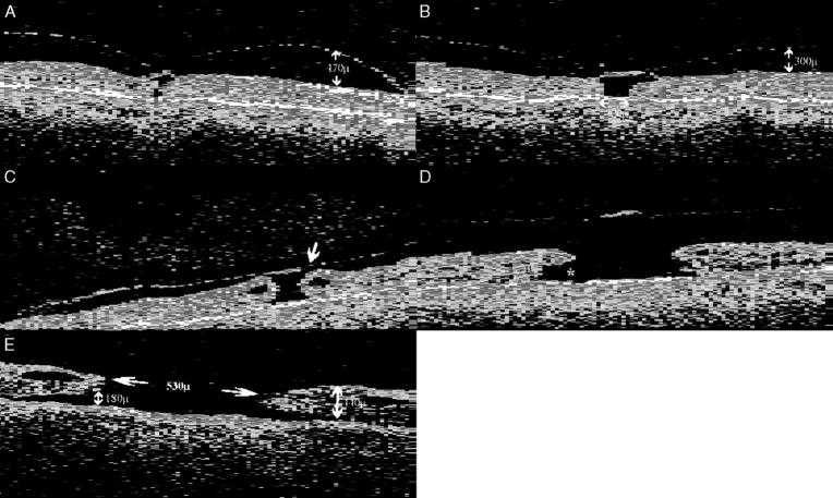 Figure 2  