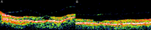 Figure 3  