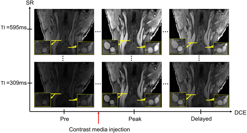 Figure 3: