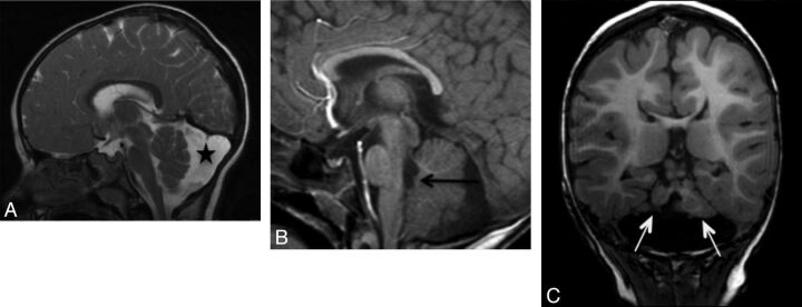 Fig 2.