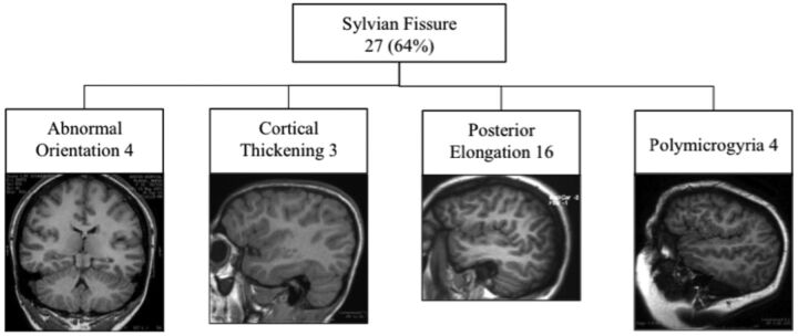 Fig 5.