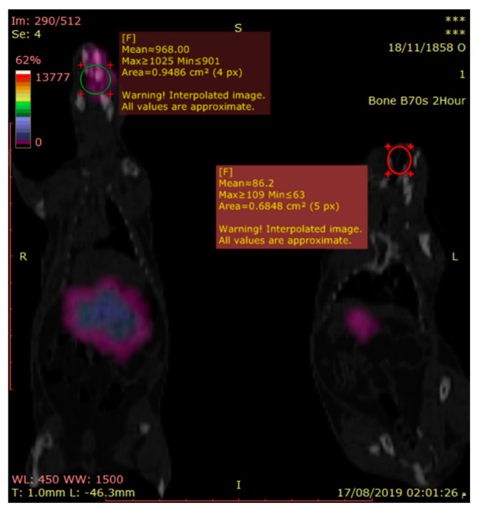 Figure 11