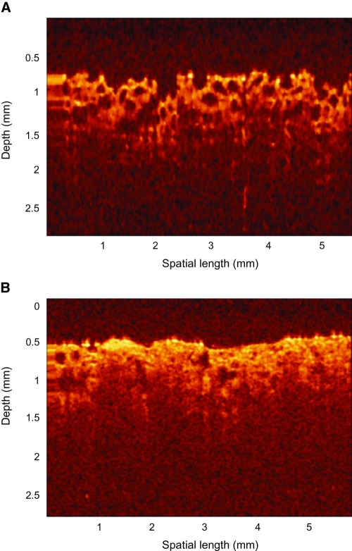 FIG. 12.