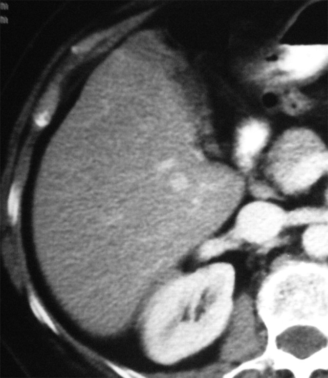 Figure 1c: