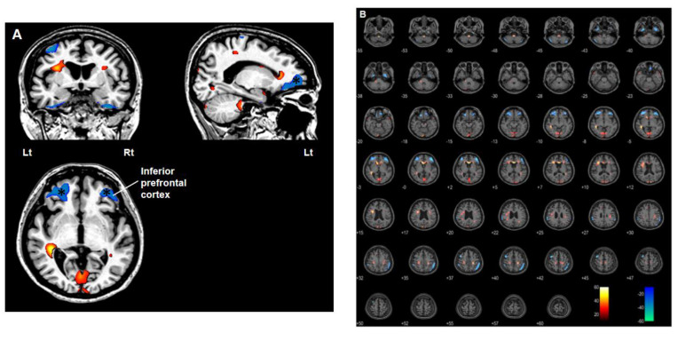 Figure 7