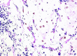 Fig. 2b
