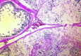 Fig. 2a