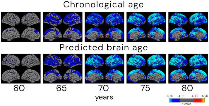 Figure 11