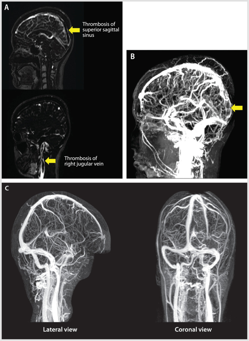 Figure 5-3.