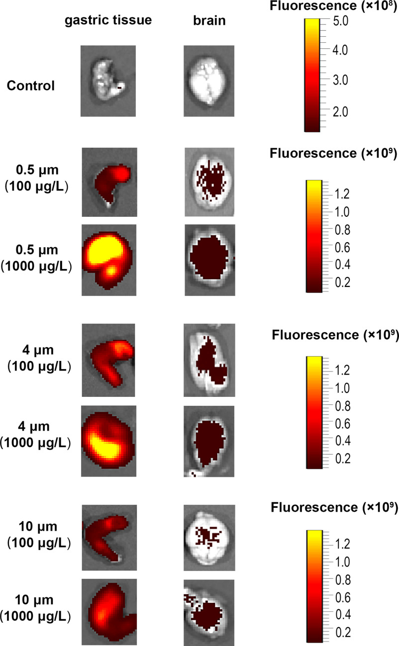 Figure 2 is a stained tissue with two columns, namely, gastric tissue and brain and seven rows, namely, control, 0.5 micrometer (100 micrograms per liter), 0.5 micrometer (1,000 micrograms per liter), 4 micrometers (100 micrograms per liter), 4 micrometers (1,000 micrograms per liter), 10 micrometers (100 micrograms per liter), and 10 micrometers (1,000 micrograms per liter). A scale depicts Fluorescence (times 10 begin superscript 8 end superscript) ranging from 2.0 to 5.0 in increments of 1.0 for control. Scales depict Fluorescence (times 10 begin superscript 9 end superscript) ranging from 0.2 to 1.2 in increments of 0.2 for 0.5 micrometer (100 micrograms per liter), 0.5 micrometer (1,000 micrograms per liter), 4 micrometers (100 micrograms per liter), 4 micrometers (1,000 micrograms per liter), 10 micrometers (100 micrograms per liter), and 10 micrometers (1,000 micrograms per liter).