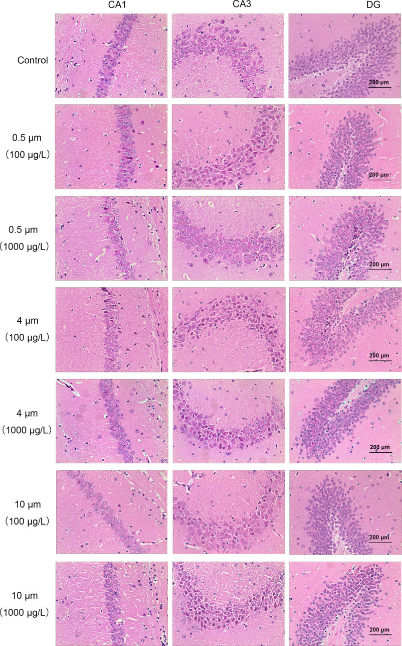 Figure 6 is a stained tissue with three columns, namely, C A 1, C A 3, and D G, and seven rows, namely, control, 0.5 micrometer (100 micrograms per liter), 0.5 micrometer (1,000 micrograms per liter), 4 micrometers (100 micrograms per liter), 4 micrometers (1,000 micrograms per liter), 10 micrometers (100 micrograms per liter), and 10 micrometers (1,000 micrograms per liter) with a scale bar of 200 micrometers.