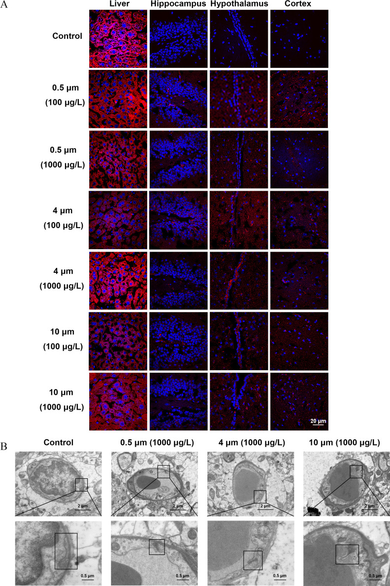 Figure 3A is a stained tissue with four columns, namely, Liver, Hippocampus, Hypothalamus, and Cortex and seven rows, control, 0.5 micrometer (100 micrograms per liter), 0.5 micrometer (1,000 micrograms per liter), 4 micrometers (100 micrograms per liter), 4 micrometers (1,000 micrograms per liter), 10 micrometers (100 micrograms per liter), and 10 micrometers (1,000 micrograms per liter) with scale bar of 20 micrometers. Figure 3B is a transmission electron microscopy photomicrograph of tissue with four columns, namely, Control, 0.5 micrometer (1,000 micrograms per liter), 4 micrometers (1,000 micrograms per liter), and 10 micrometers (1,000 micrograms per liter).