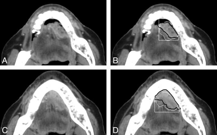 Fig 2.