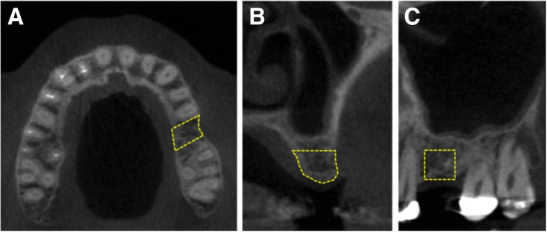 Fig. 2