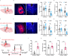 Figure 5A is a schematic diagram depicting the viral injection and optogenetics with the adeno-associated virus-calmodulin-dependent protein kinase 2-channelrhodopsin-2-mCherry-expressing medial geniculate body fibers within lateral amygdala and 473 nanometers of light Figure 5B is a stained tissue that displays the typical images of the viral injection in the medial geniculate body and an optical fiber track above the lateral amygdala with channelrhodopsin-2-expressing medial geniculate body fibers. Figures 5C, 5D, 5G, and 5H are clustered bar graphs, plotting time in center, ranging from 0 to 60 in increments of 20; time in open arms (second), ranging from 0 to 150 in increments of 50; time in center (second), ranging from 0 to 60 in increments of 20; and time in open arms (second), ranging from 0 to 150 in increments of 50 (y-axis) across mCherry and channelrhodopsin-2 (x-axis). Figure 5I is a timeline depicting the chemogenetic experiments including adeno-associated virus-calmodulin-dependent protein kinase 2-channelrhodopsin-2-mCherry-expressing lateral amygdala, medial geniculate, clozapine-N-oxide, auditory cortex. Between days 0 and 1, habituation was conducted. Between days 1 and 28, noise exposure was conducted. From day 14, daily clozapine-N-oxide injections were started. From day 28, open field tests or elevated plus mazes began. Figures 5J, 5K, and 5L are bar graphs, plotting time in center (second), ranging from 0 to 50 in increments of 10; total distance (centimeter), ranging from 0 to 4000 in increments of 1000; time in open arms (second), ranging from 0 to 120 in increments of 40 (y-axis) across mCherry and human M4 muscarinic receptor (x-axis).