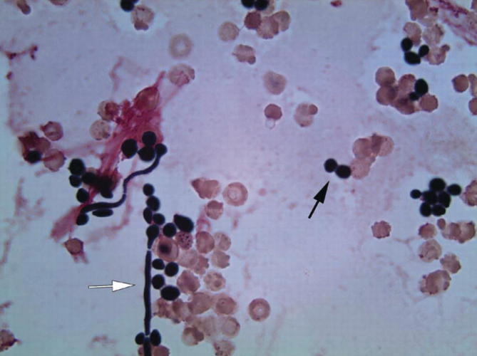 Fig. 9.18