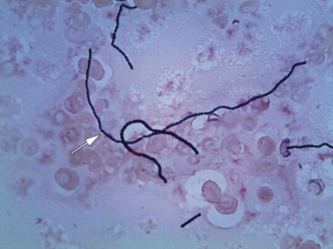 Fig. 9.11