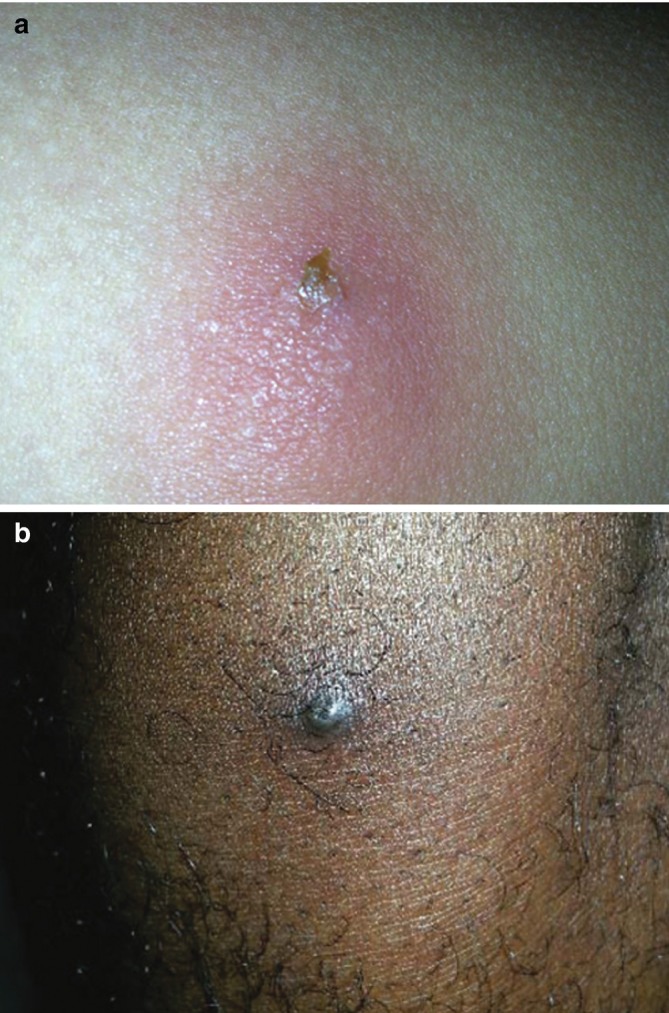Fig. 9.9