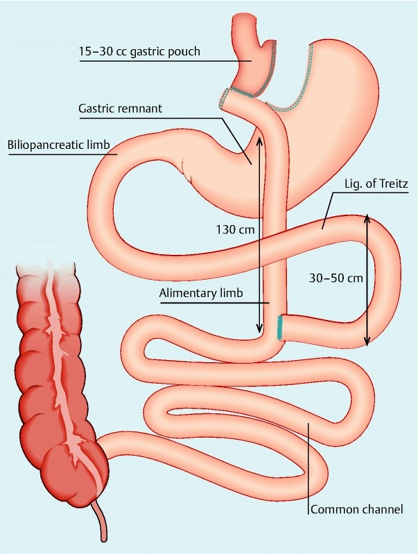 Fig. 1