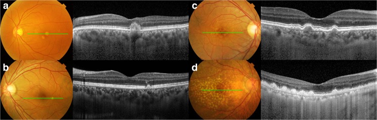 Fig. 3