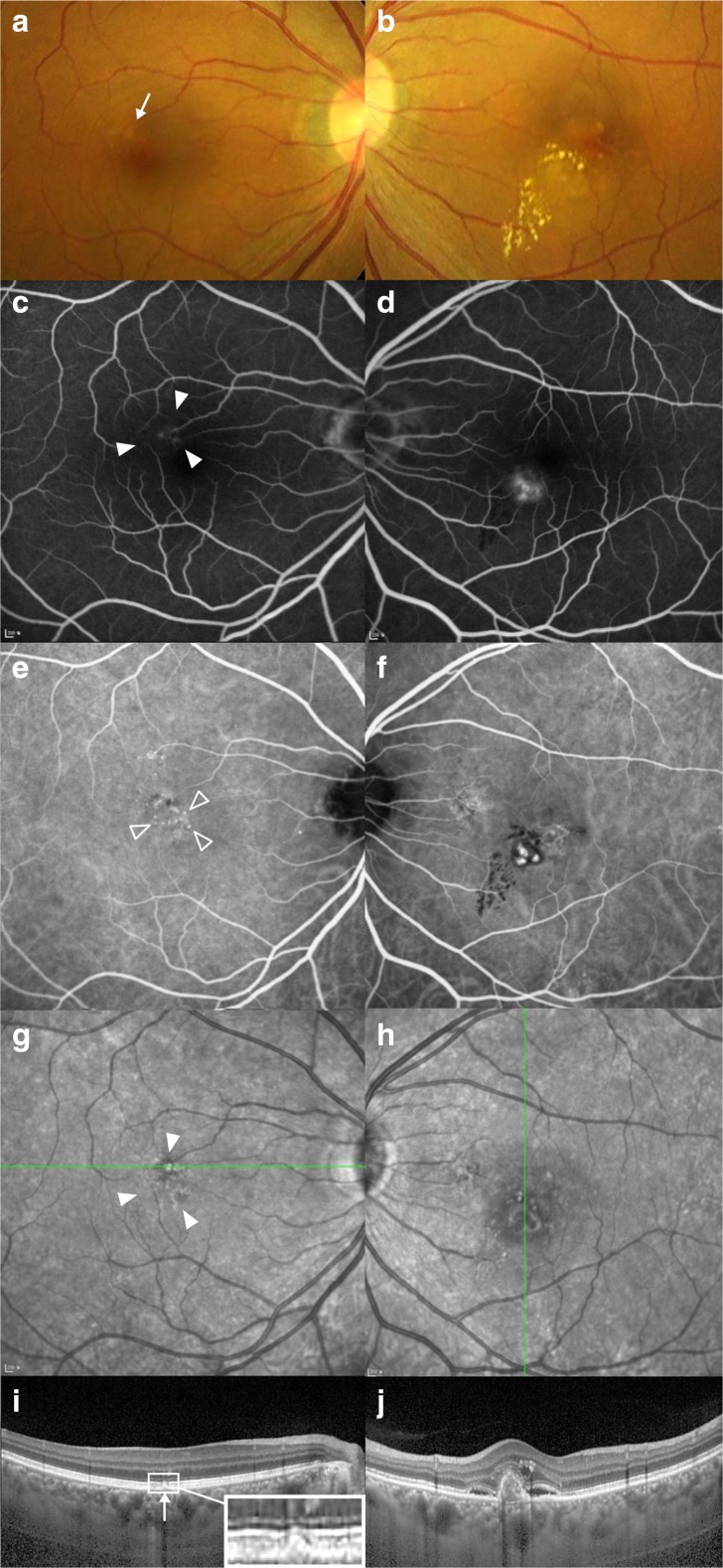 Fig. 1