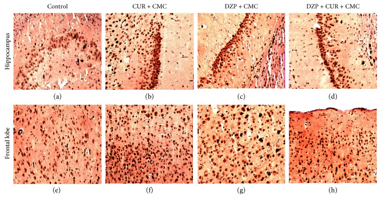 Figure 11