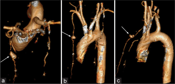 Figure 11: