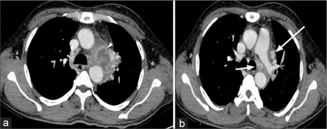 Figure 4: