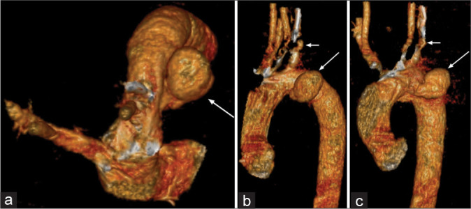 Figure 3: