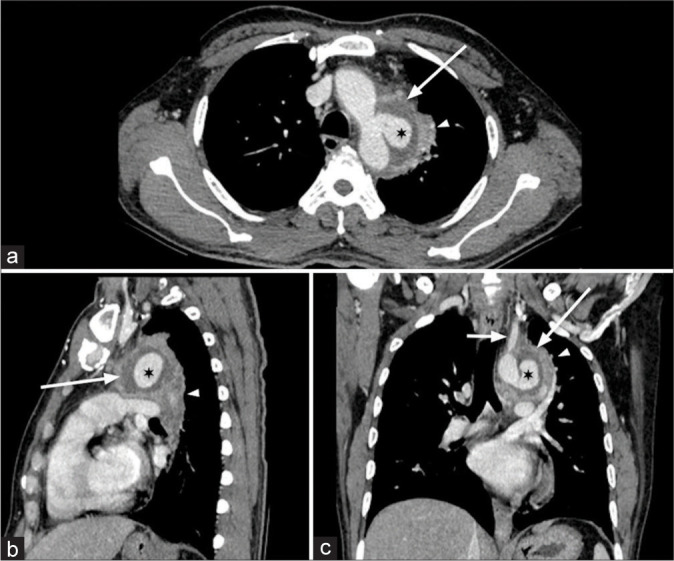 Figure 2: