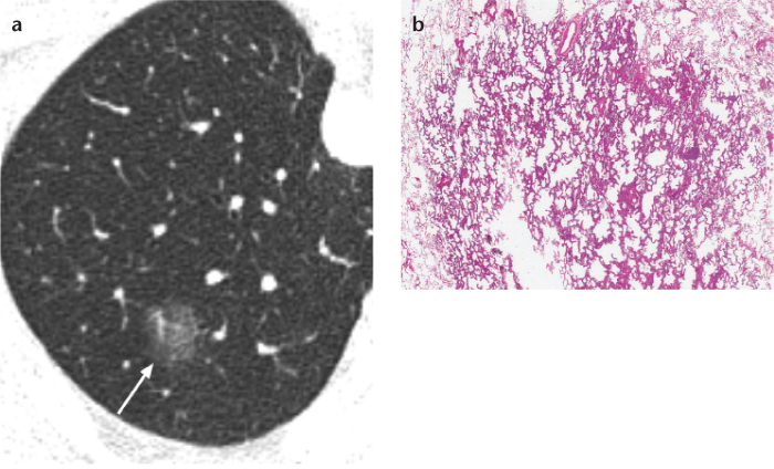 Figure 2. a, b.