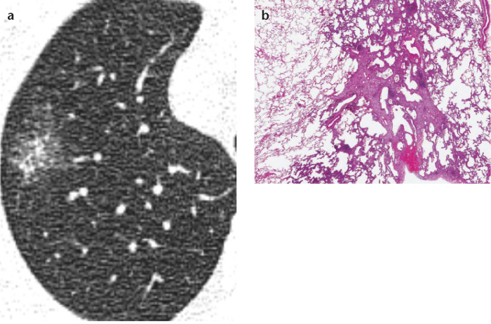 Figure 3. a, b.