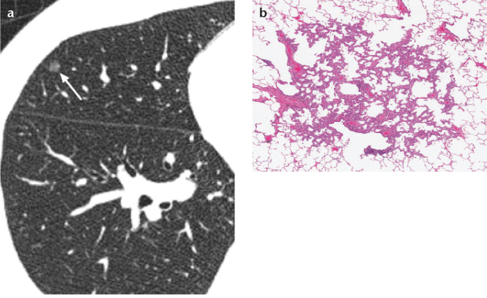 Figure 1. a, b.