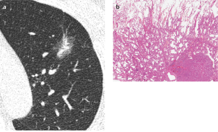 Figure 4. a, b.