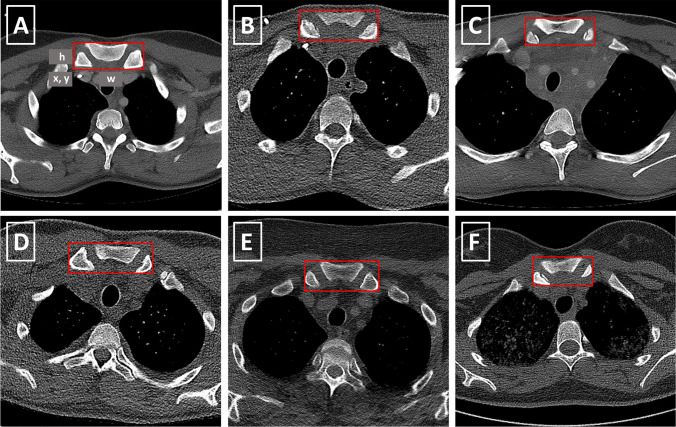 Fig. 3