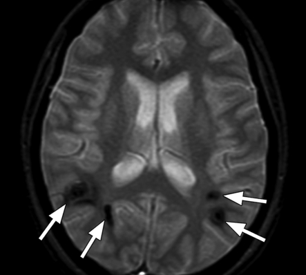 Figure 4b