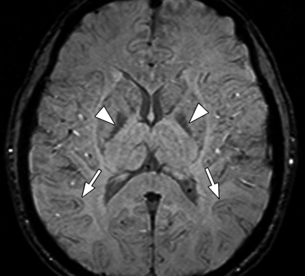 Figure 10c