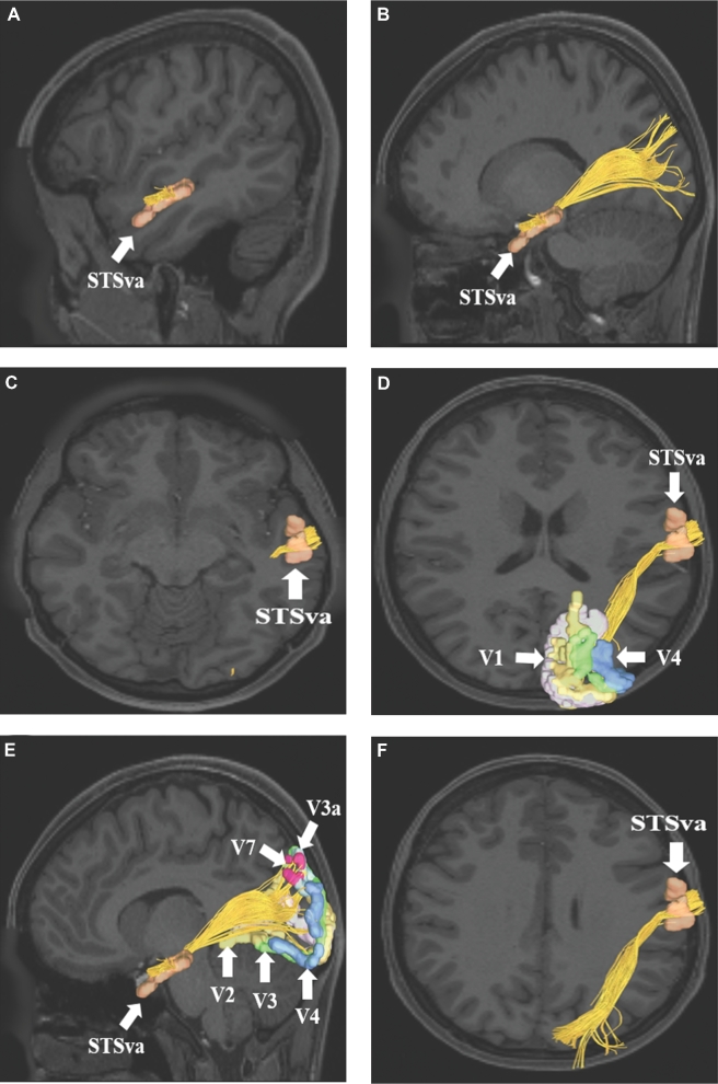 FIGURE 4.