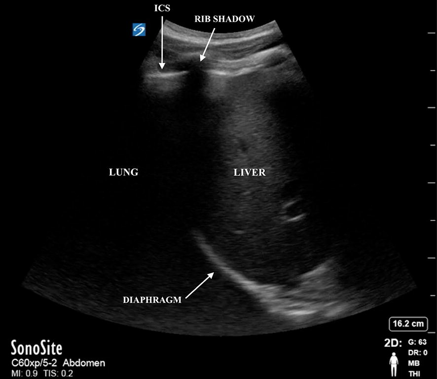 Fig. 1