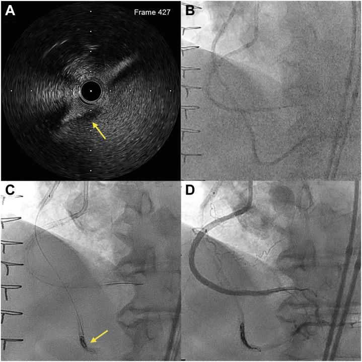 Figure 3