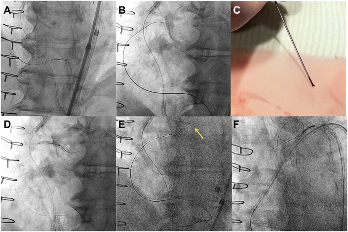 Figure 2